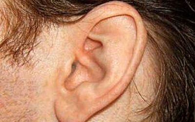 Craniosacral and tinnitus